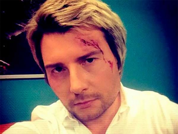 Басков разбил голову на свадьбе дочери Крутого