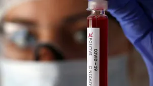 Еще 63 человека заразились COVID-19 в Казахстане