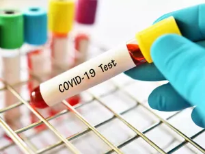 Народ жалуется на нехватку тестов на COVID-19 – депутат мажилиса